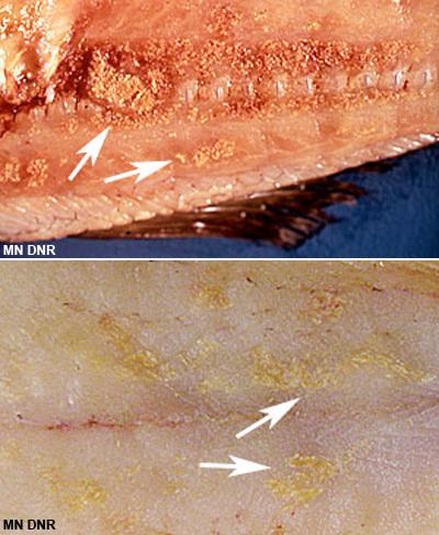 myofibrogranuloma_b.jpg